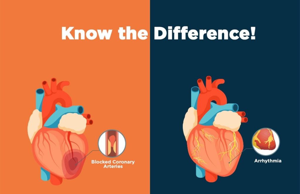 Heart Attack vs Cardiac Arrest Key Differences Dr. Dhananjay Zutshi